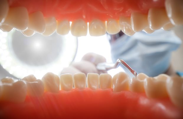 dental-extraction