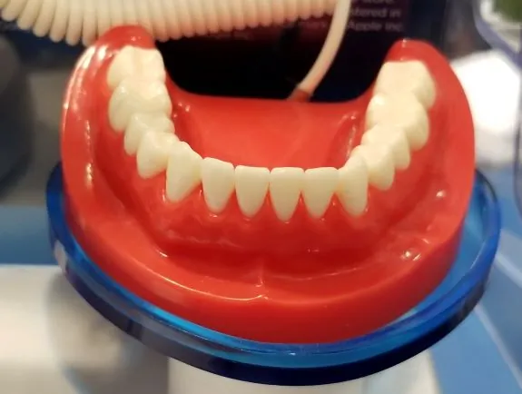dental-extraction