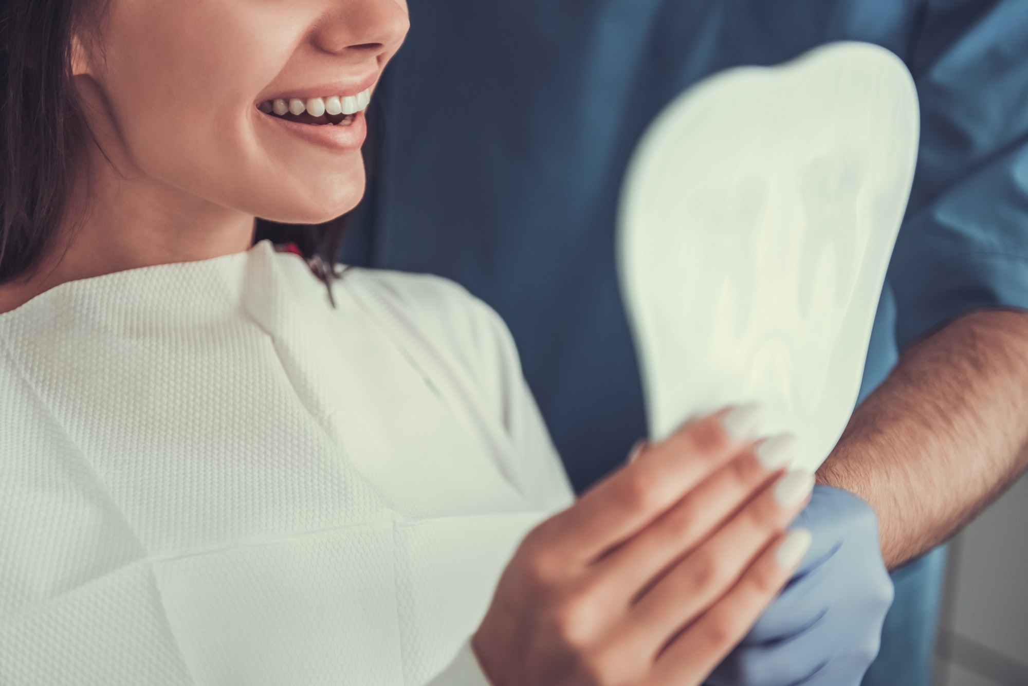 Veneers