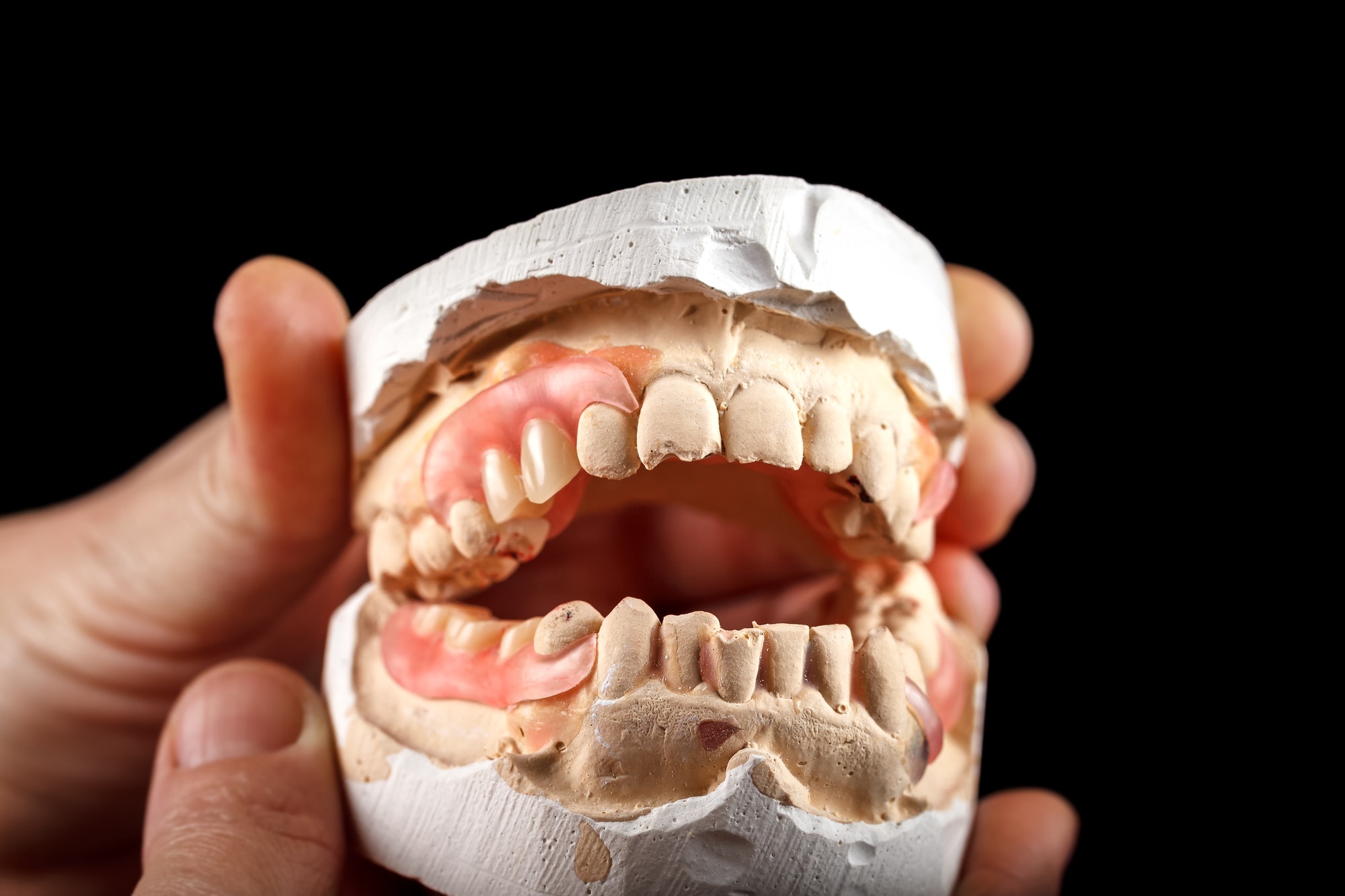 A denture on a gypsum base in the hand of a dentist. Close-up on a black background