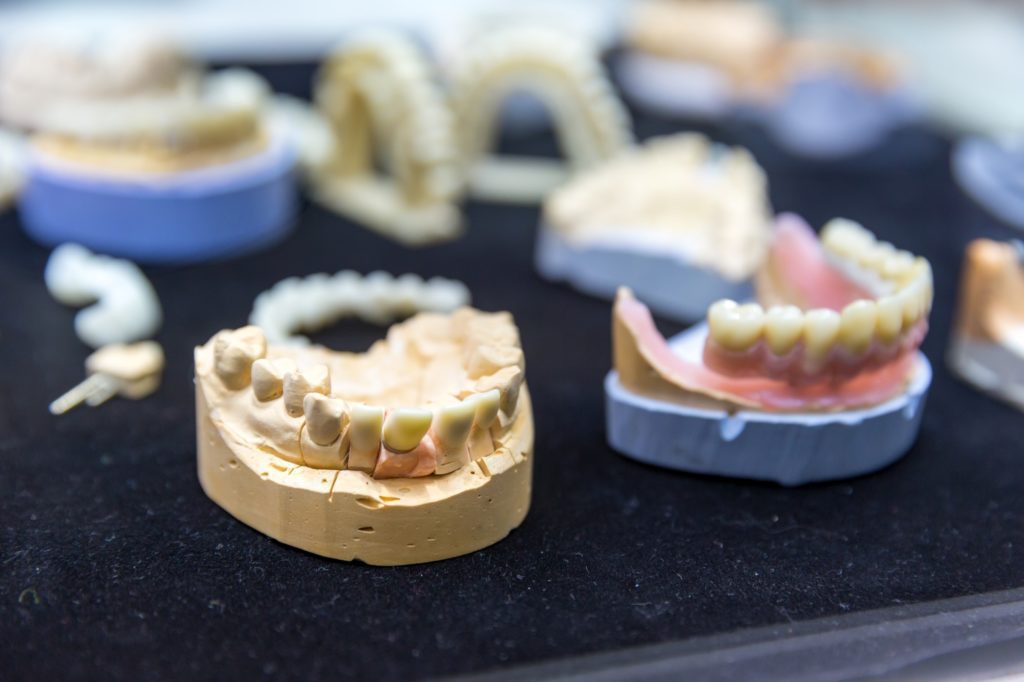 Denture, prosthetic dentistry, dental implants