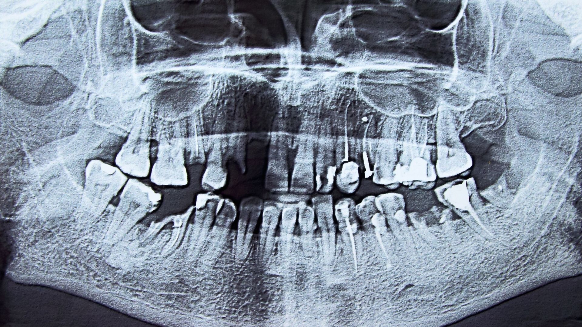intraoral dental