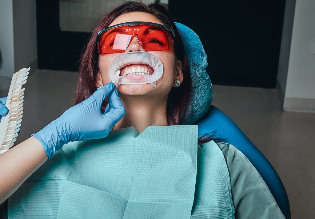 inspecting teeth whitening