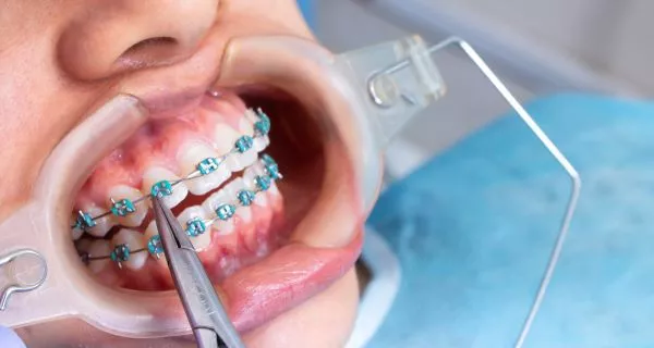 Treatment Duration and Recovery