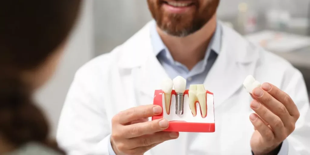 Implantes Dentales en Santa Paula | Channel Islands Family Dental