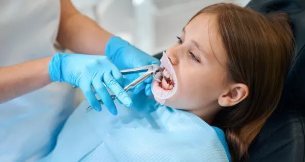 Types of extractions we perform at our Santa Paula Office