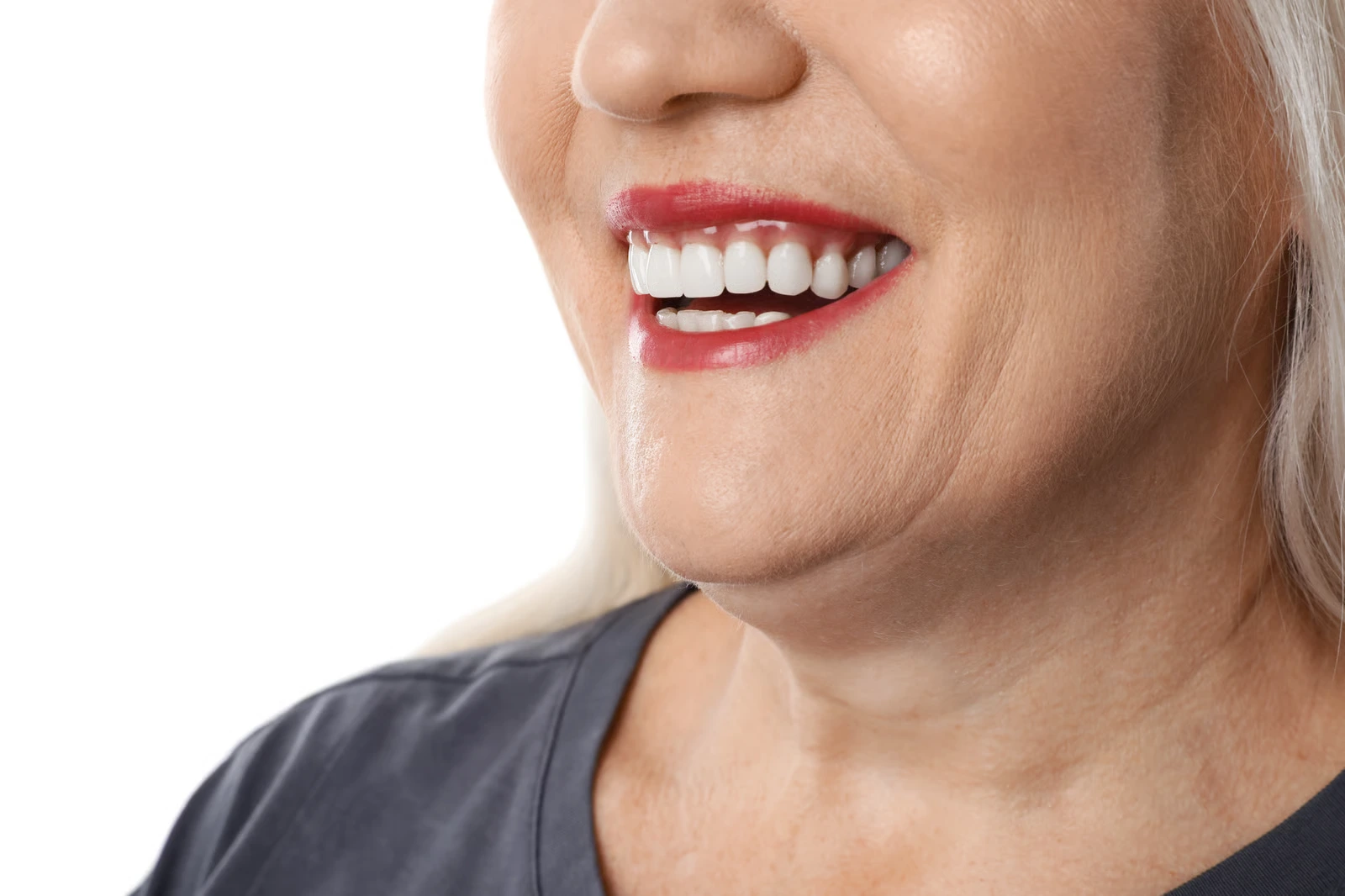 All On 4 Dental Implants in Santa Paula