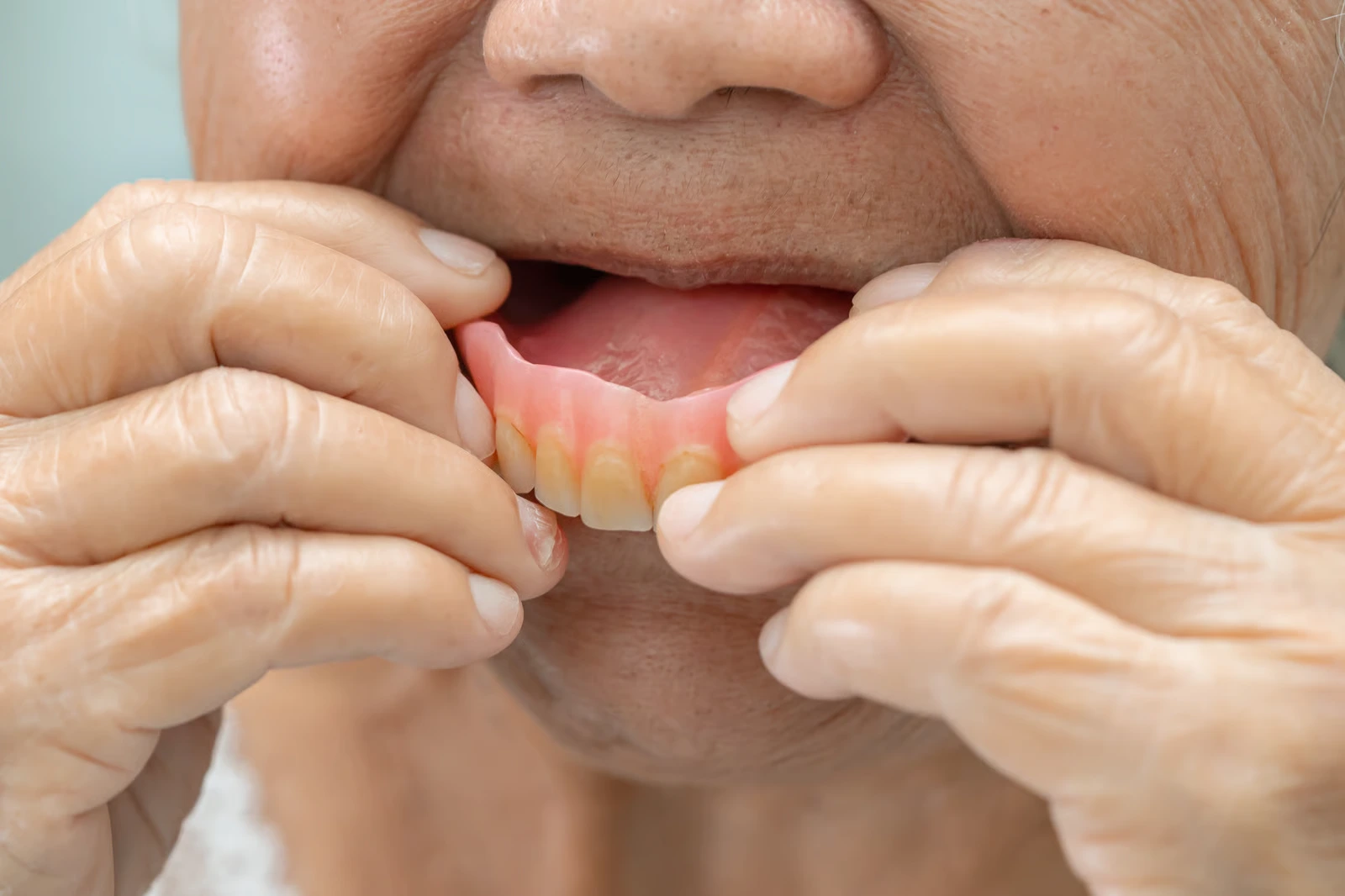 Denturas Postizas en Santa Paula
