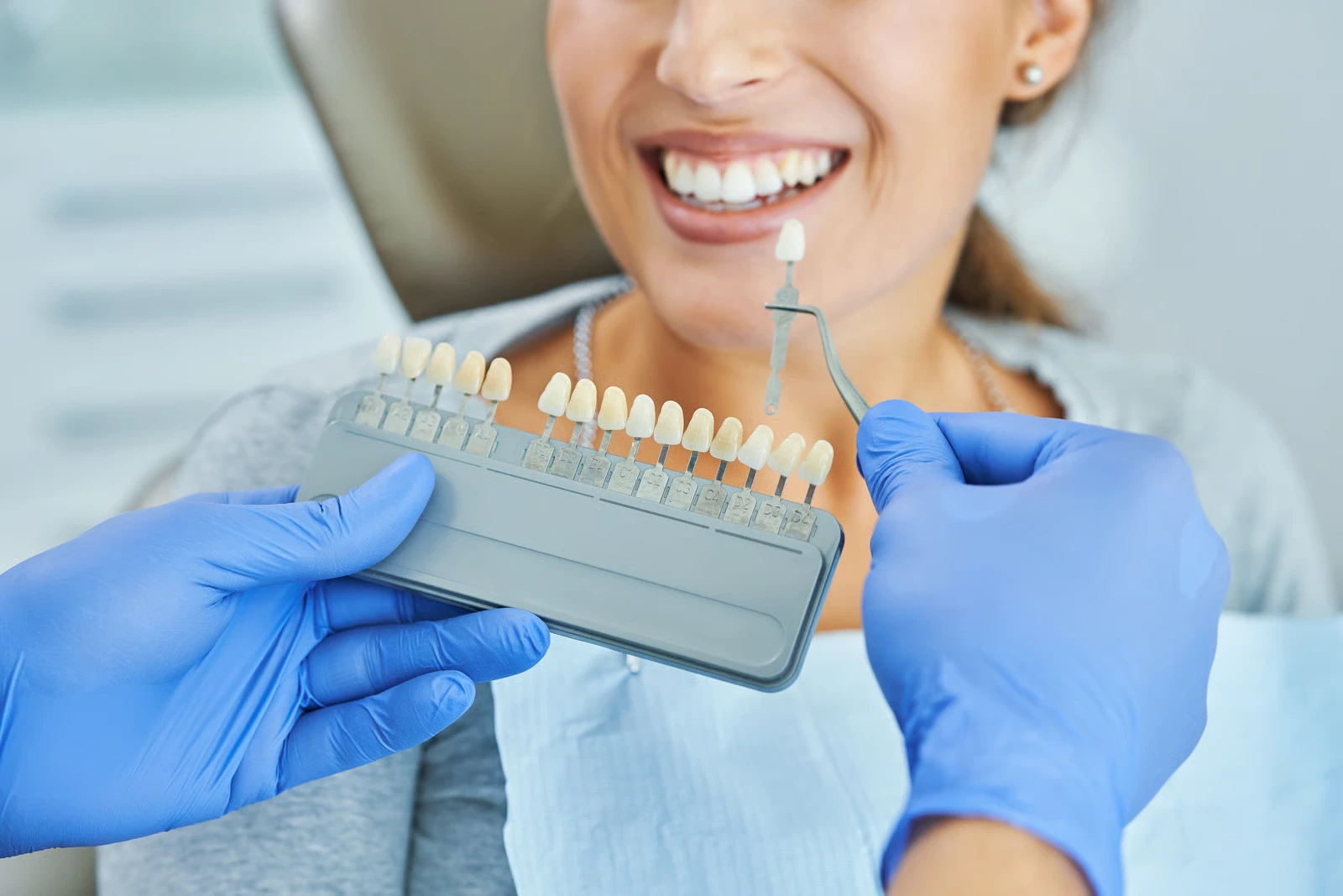 Veneers Near Me in Santa Paula